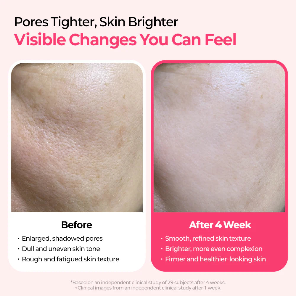 Cemenrete Cyano Pink Spicule Line