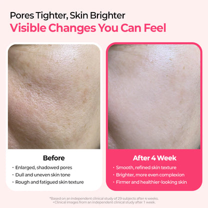 Cemenrete Cyano Pink Spicule Line