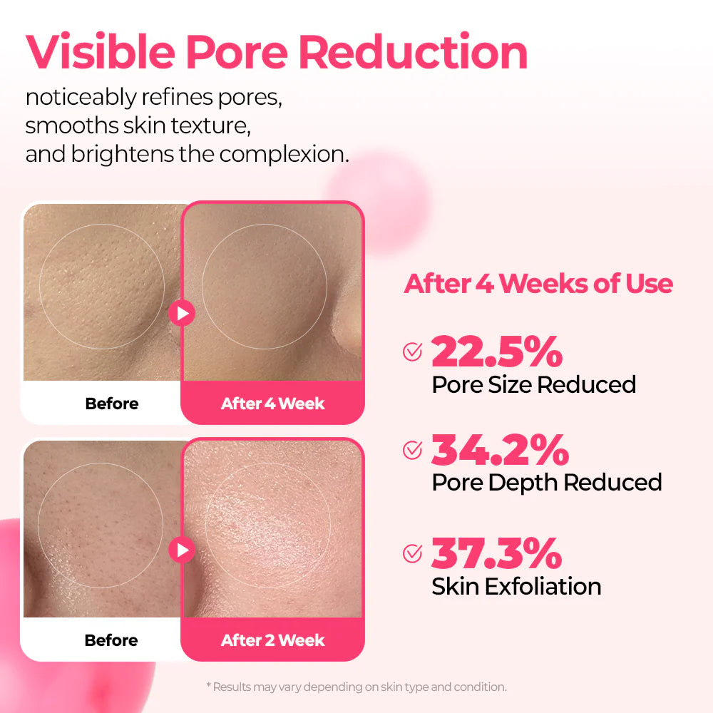 Cemenrete Cyano Pink Spicule Line