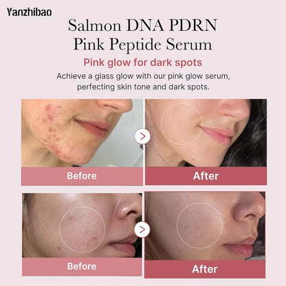 OEM Salmon DNA + PDRN Face Serum Pink Peptide&Niacinamide Korean Skincare for Moisturizing, Brightening